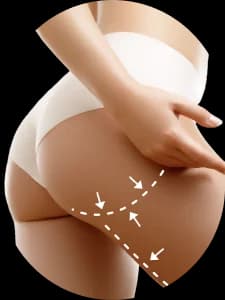 Liposukce